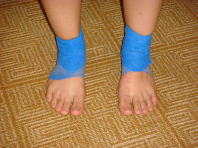 bandaged-feet